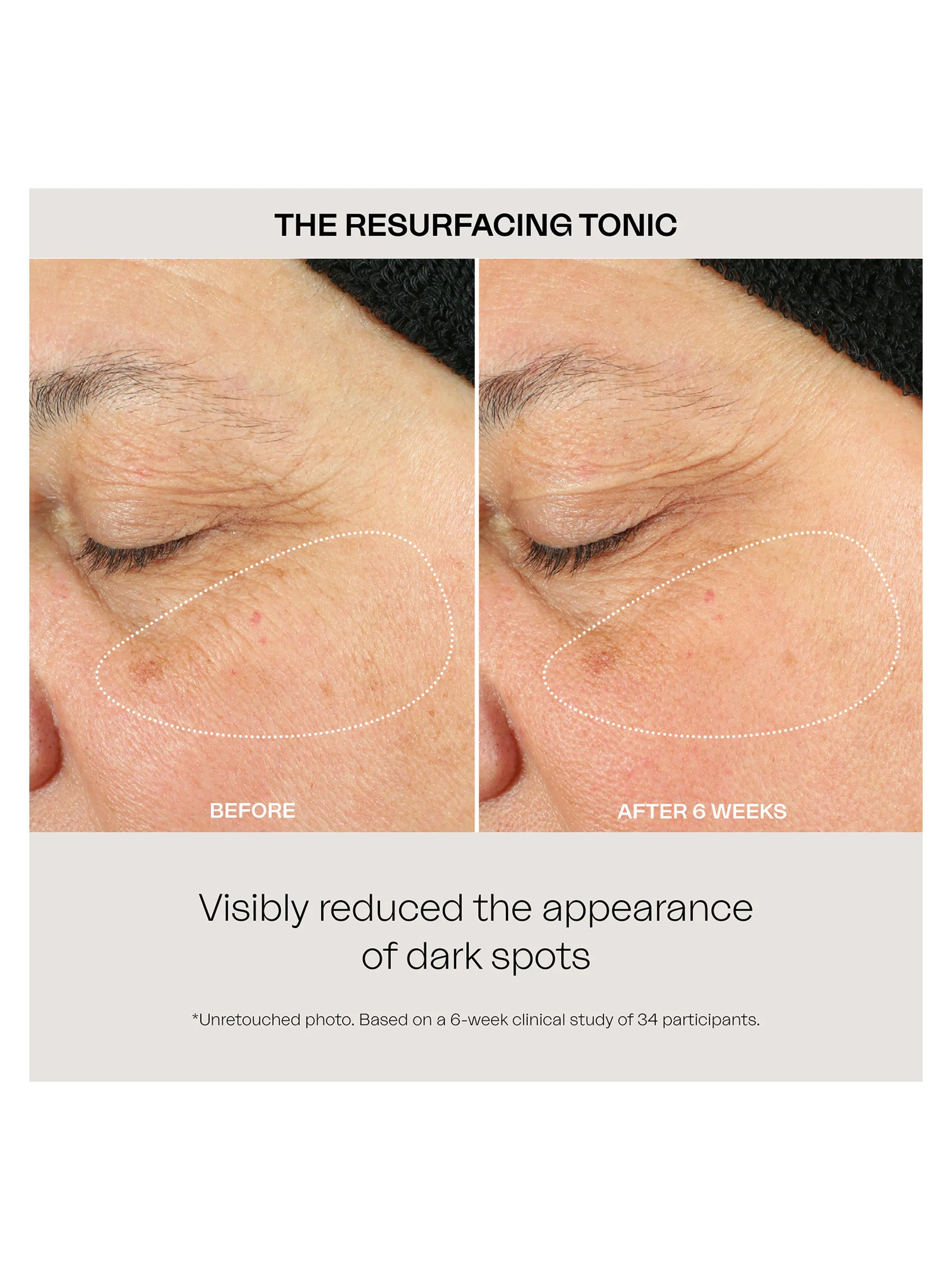 Resurfacing Tonic
